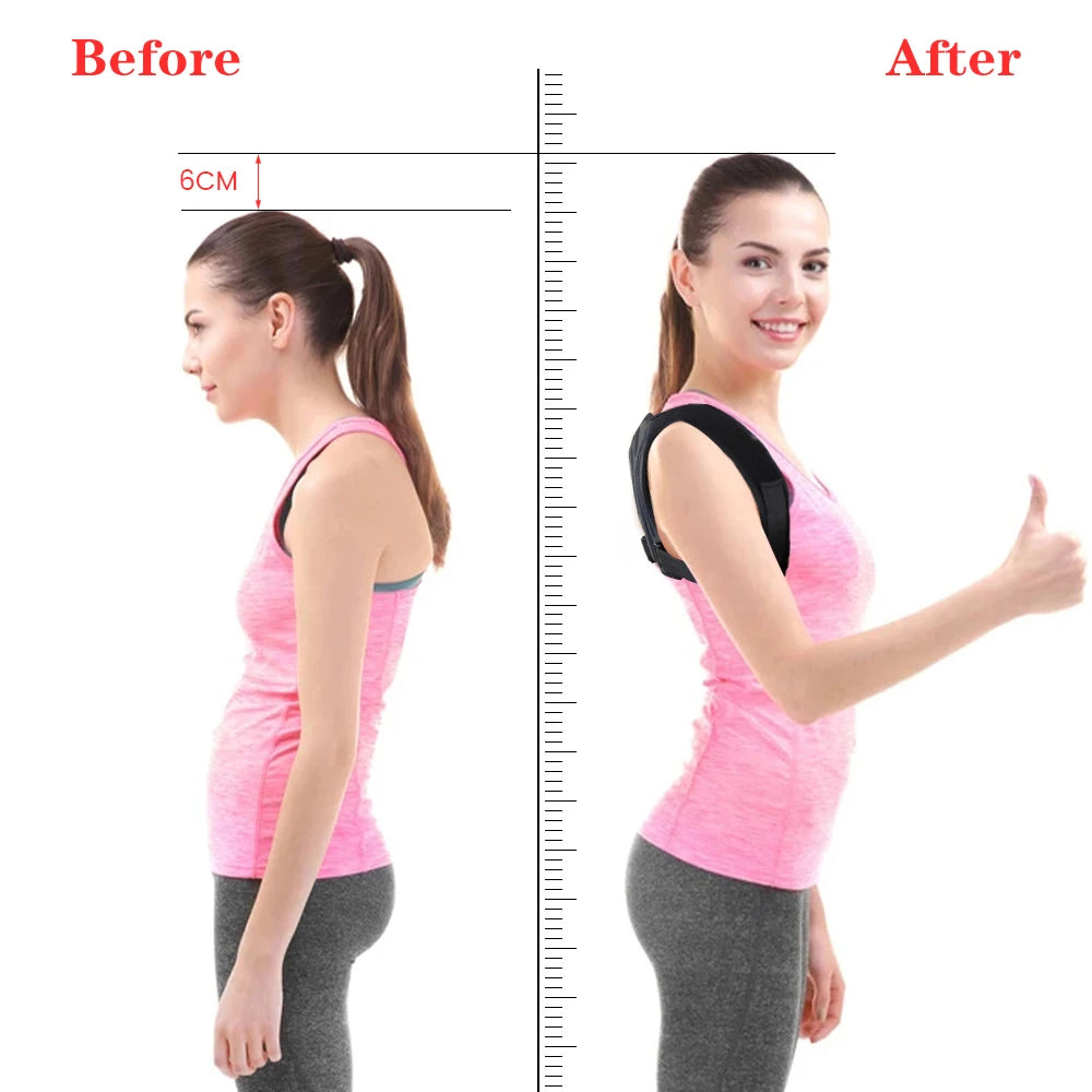 Back Posture Corrector